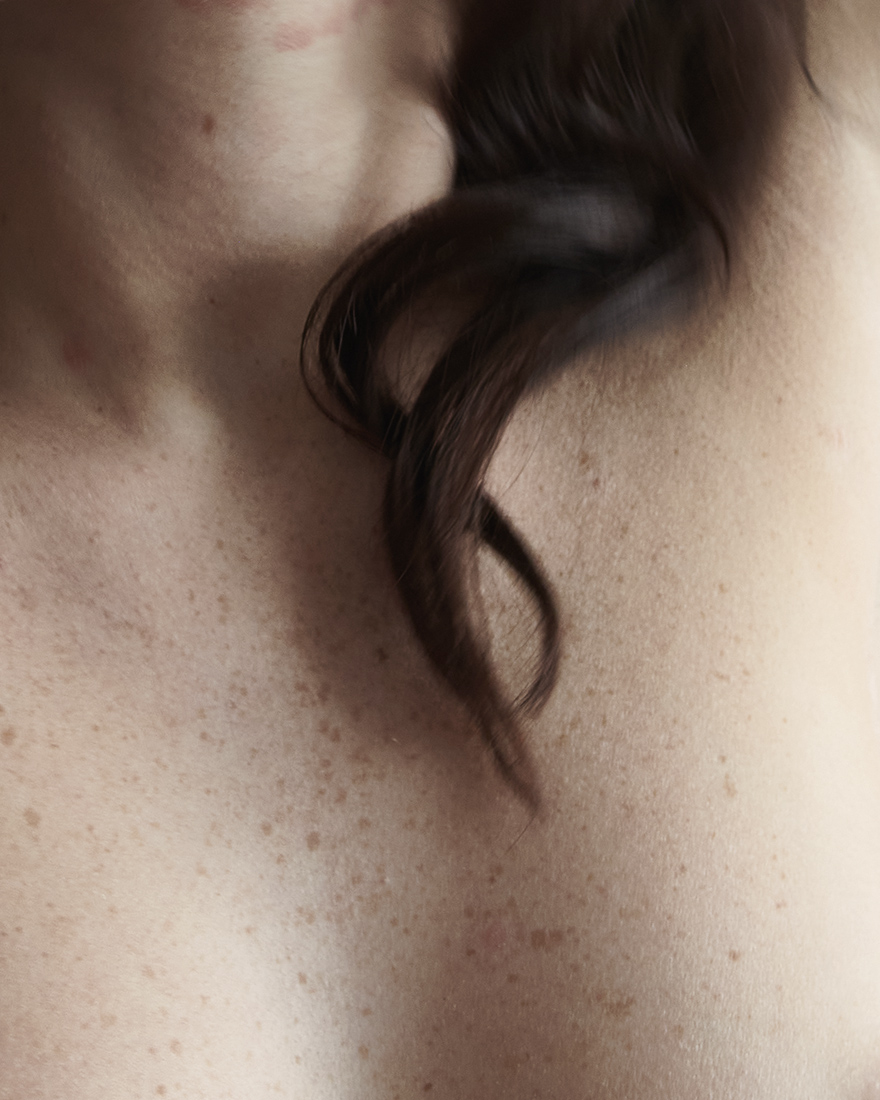 Freckles skin photographer